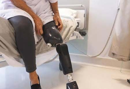 Gold Standard Considerations in Lower Limb Prosthetic Care Gold Standard Considerations in Lower Limb Prosthetic Care